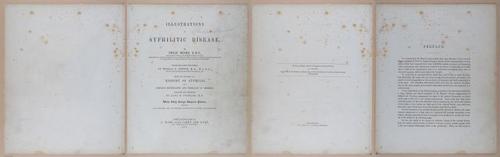 E345 - Illustrations of Syphilitic - i11784-11785-11789