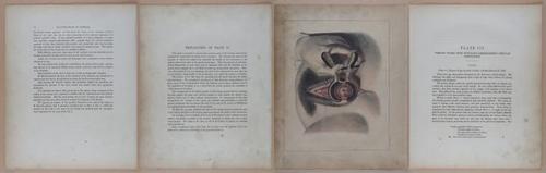 E345 - Illustrations of Syphilitic - i11862-11863-11864-11865