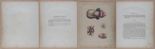 E345 - Illustrations of Syphilitic - i11882-11883-11884