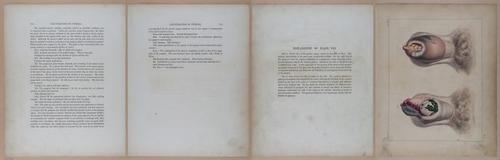 E345 - Illustrations of Syphilitic - i11900-11901-11902-11903
