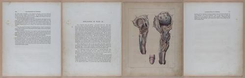 E345 - Illustrations of Syphilitic - i11918-11919-11920-11921