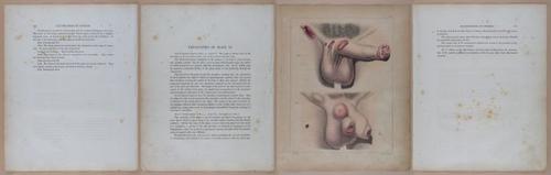 E345 - Illustrations of Syphilitic - i11933-11934-11935-11936