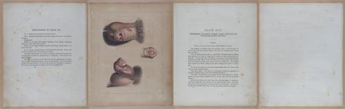 E345 - Illustrations of Syphilitic - i11941-11942-11944