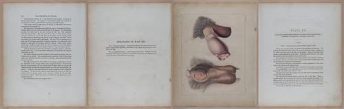 E345 - Illustrations of Syphilitic - i11953-11954-11955-11956
