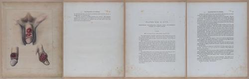 E345 - Illustrations of Syphilitic - i11965-11966-11967-11968