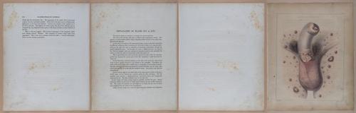 E345 - Illustrations of Syphilitic - i11973-11974-11975-11976