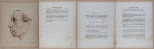 E345 - Illustrations of Syphilitic - i11977-11978-11979-11980
