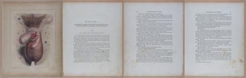 E345 - Illustrations of Syphilitic - i11985-11986-11987-11988