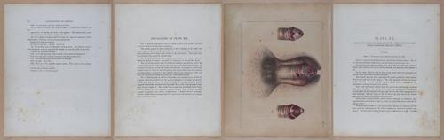 E345 - Illustrations of Syphilitic - i11989-11990-11991-11992