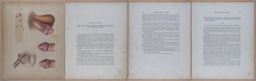 E345 - Illustrations of Syphilitic - i12004-12005-12006-12007