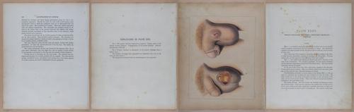 E345 - Illustrations of Syphilitic - i12008-12009-12010-12011