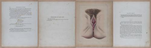 E345 - Illustrations of Syphilitic - i12012-12013-12014-12015