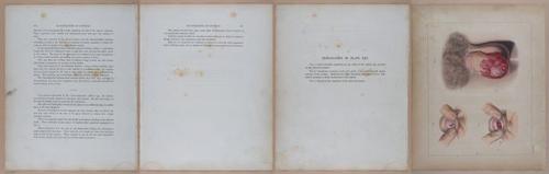 E345 - Illustrations of Syphilitic - i12024-12025-12026-12027