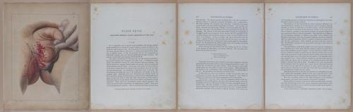 E345 - Illustrations of Syphilitic - i12033-12034-12035-12036