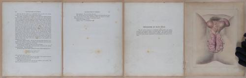 E345 - Illustrations of Syphilitic - i12041-12042-12043-12044