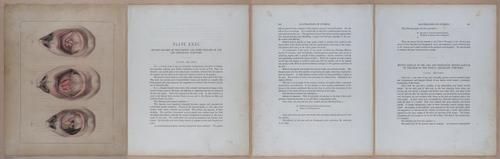 E345 - Illustrations of Syphilitic - i12057-12058-12059-12061