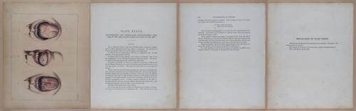 E345 - Illustrations of Syphilitic - i12073-12074-12075-12076