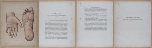 E345 - Illustrations of Syphilitic - i12077-12078-12079-12080