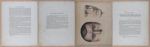 E345 - Illustrations of Syphilitic - i12086-12087-12088-12089
