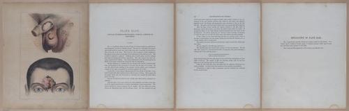 E345 - Illustrations of Syphilitic - i12124-12125-12126-12127