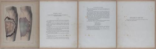 E345 - Illustrations of Syphilitic - i12128-12129-12130-12131