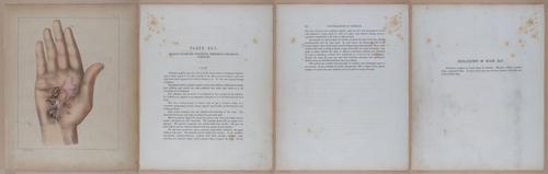 E345 - Illustrations of Syphilitic - i12132-12133-12134-12135