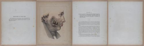 E345 - Illustrations of Syphilitic - i12157-12158-12159