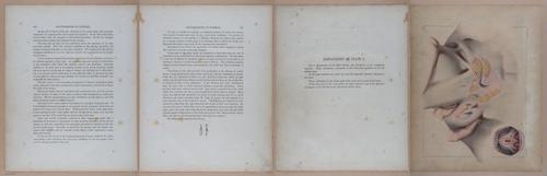 E345 - Illustrations of Syphilitic - i12164-12165-12166-12167