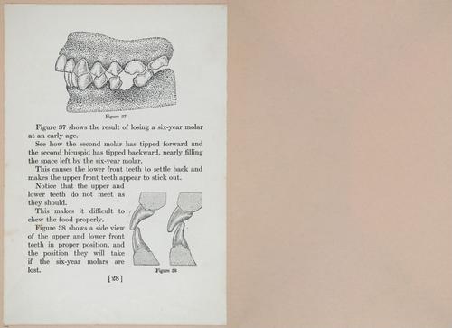 E475 - Teeth - i22566