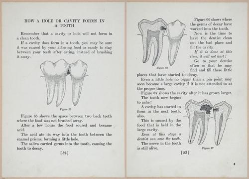 E475 - Teeth - i22589-22590