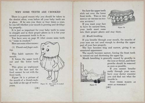 E475 - Teeth - i22595-22596