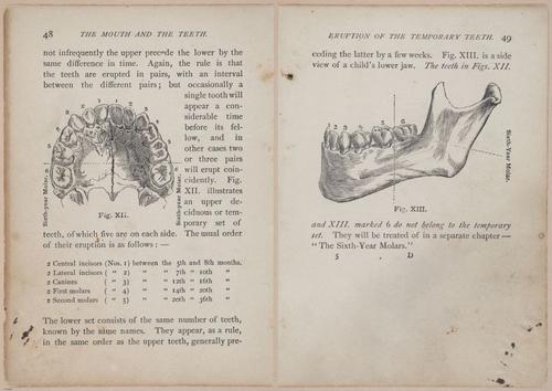 E525 - Teeth - i25112-25113