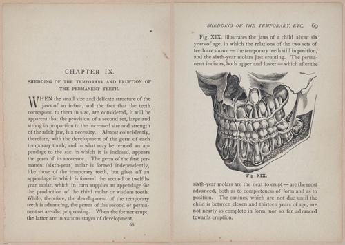 E525 - Teeth - i25132-25133
