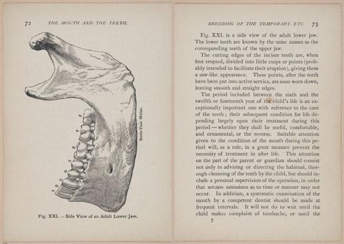 E525 - Teeth - i25136-25137
