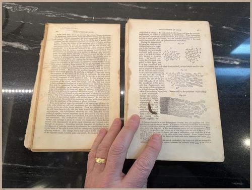 E675 - A System of Human Anatomy - 1857 - 2702