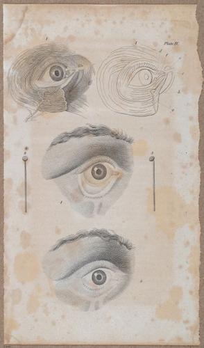 E696 - First Line of Surgery - i10014