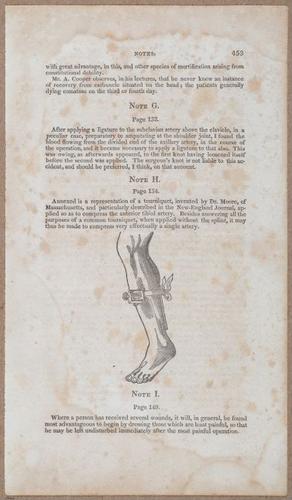 E696 - First Line of Surgery - i10018