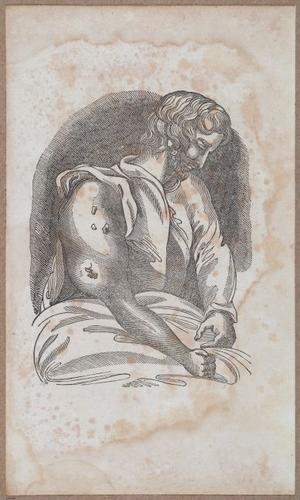 E696 - First Line of Surgery - i10019