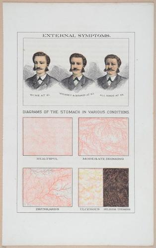 Diagrams of a Face and the Stomach